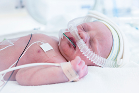 Patología respiratoria en el recién nacido