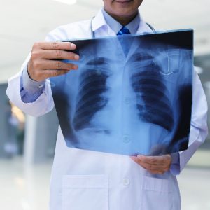 Radiografía torácica