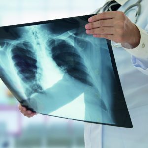 Radiología del aparato musculoesquelético