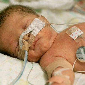 Shock séptico en pediatría