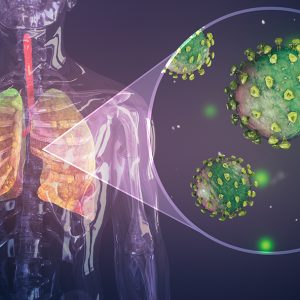 Patología respiratoria - Manejo de la neumonía adquirida en la comunidad
